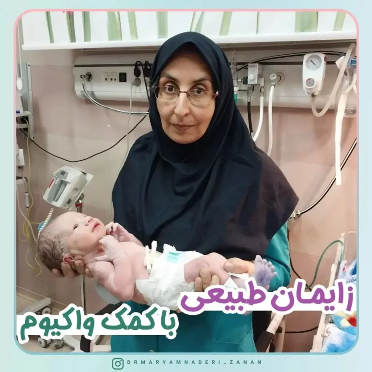 زایمان طبیعی با کمک واکیوم