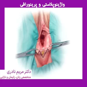 واژینوپلاستی و پرینورافی