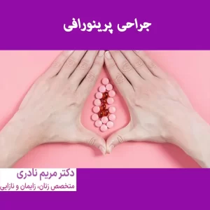 پرینورافی
