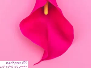 کاندیدای لابیاپلاستی