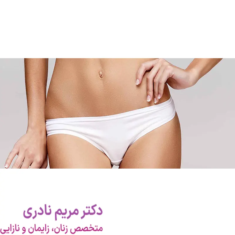 کاندیدای مناسب لابیاپلاستی