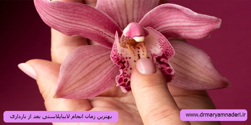 بهترین-زمان-انجام-لابیاپلاستی-بعد-از-بارداری