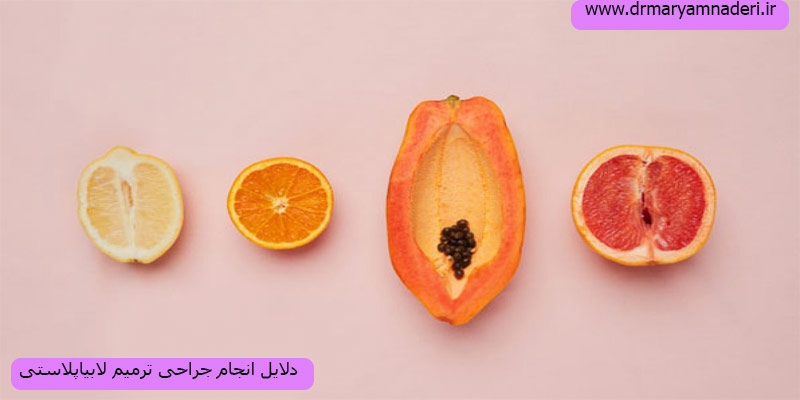 دلایل-انجام-جراحی-ترمیمی-لابیاپلاستی