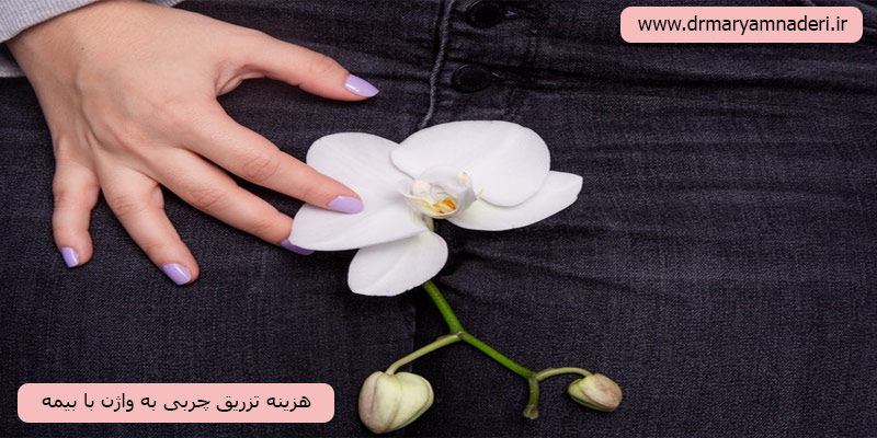 هزینه-تزریق-چربی-به-واژن-با-بیمه
